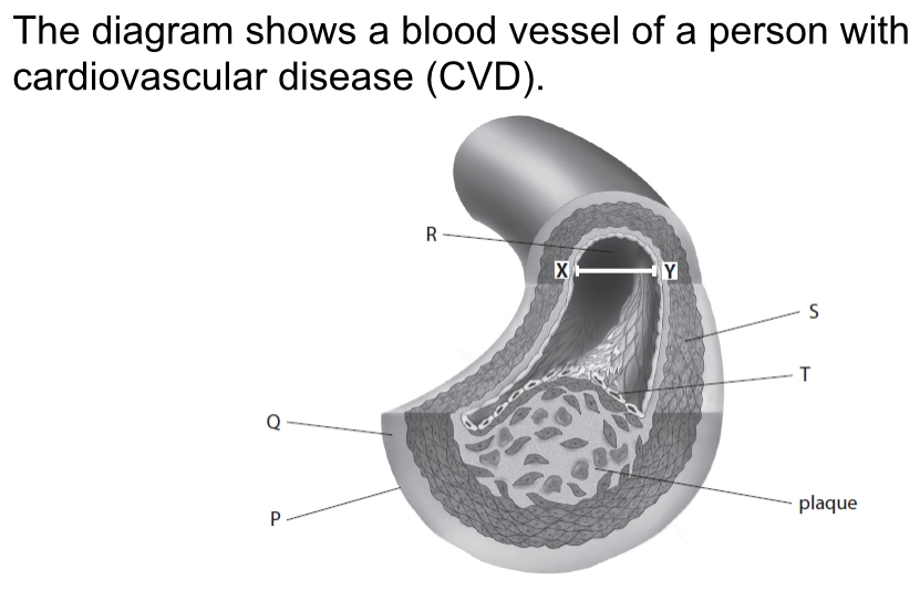 <p>Name the type of blood vessel shown in this diagram</p>