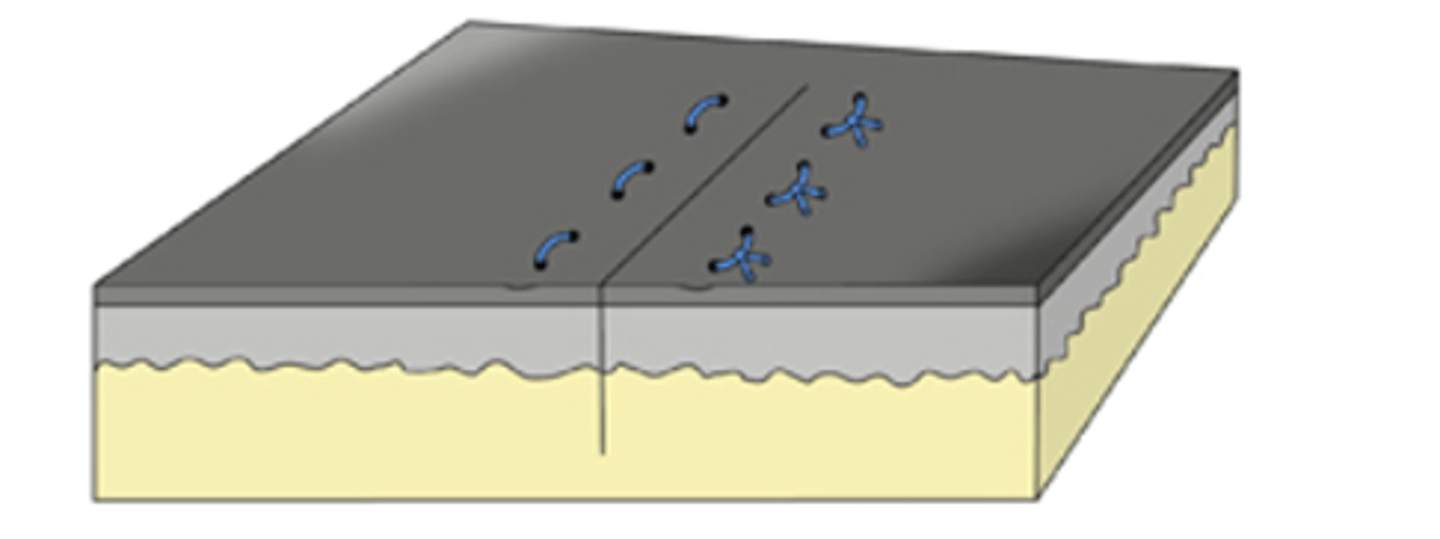 <p>- Opposes the edges of the incision, resulting faster wound healing and is more cosmetic</p>