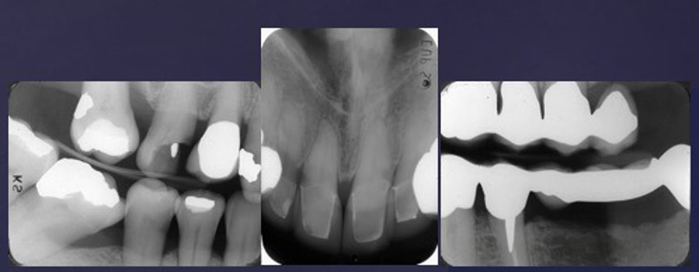 <p>Identify restoration type</p>