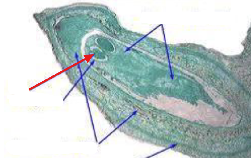 <p>What is being indicated on the Pinus Mature Ovule?</p>