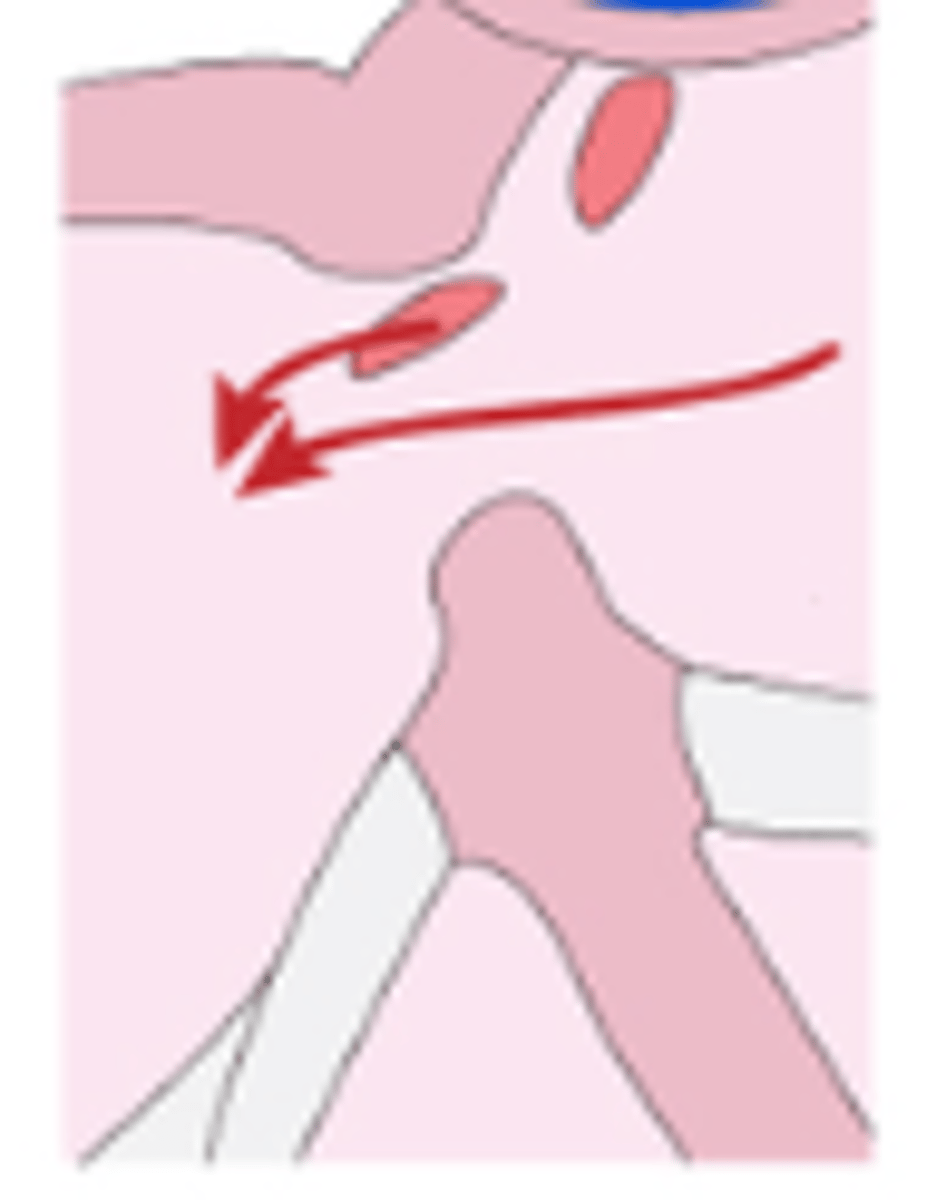 <p>found high in the septum where the pulmonary veins enter the left atrium.allow communication of one or more of the pulmonary veins with the right atrium.</p>