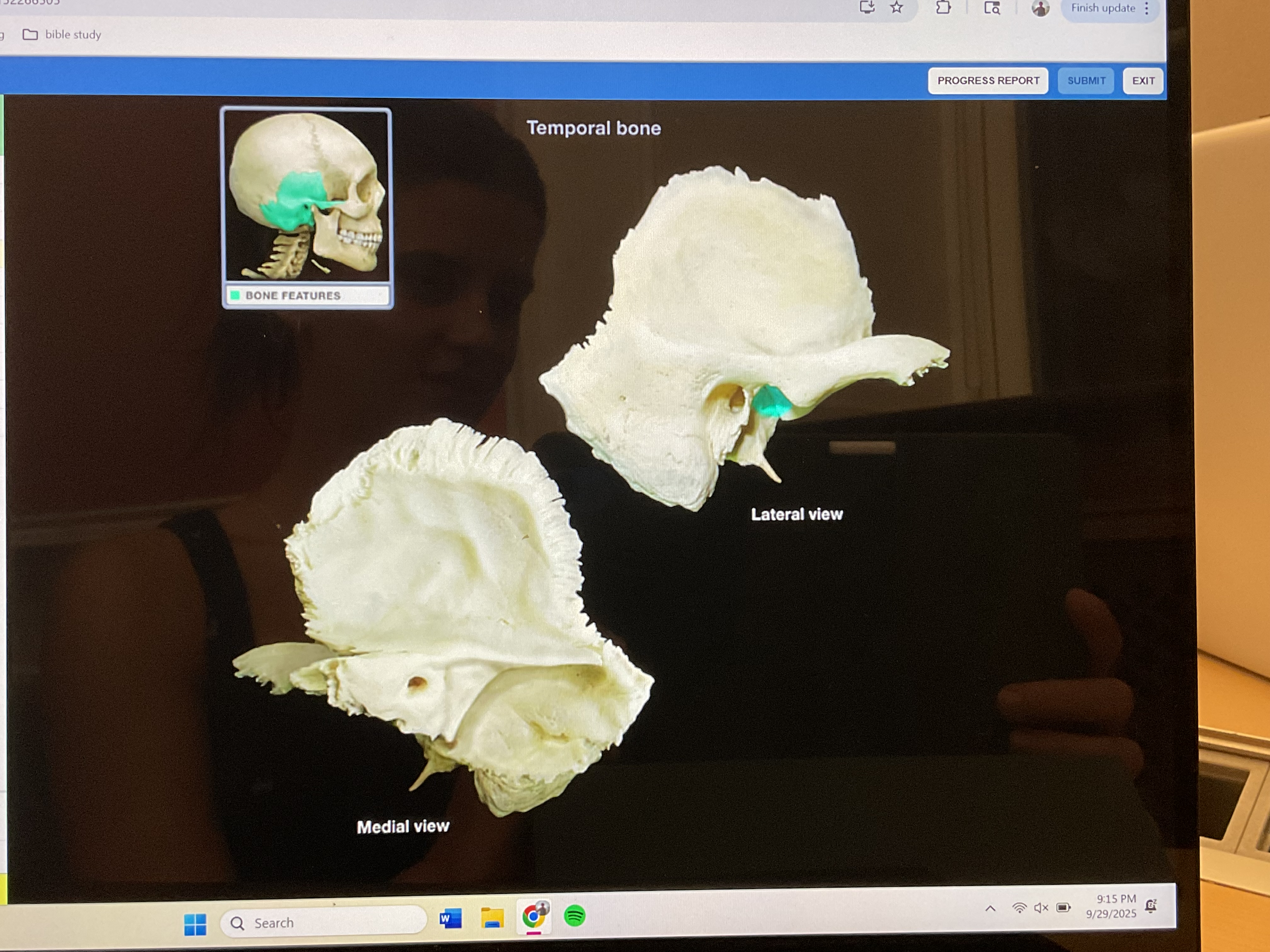 <p>Mandibular fossa (temporal bone) </p>