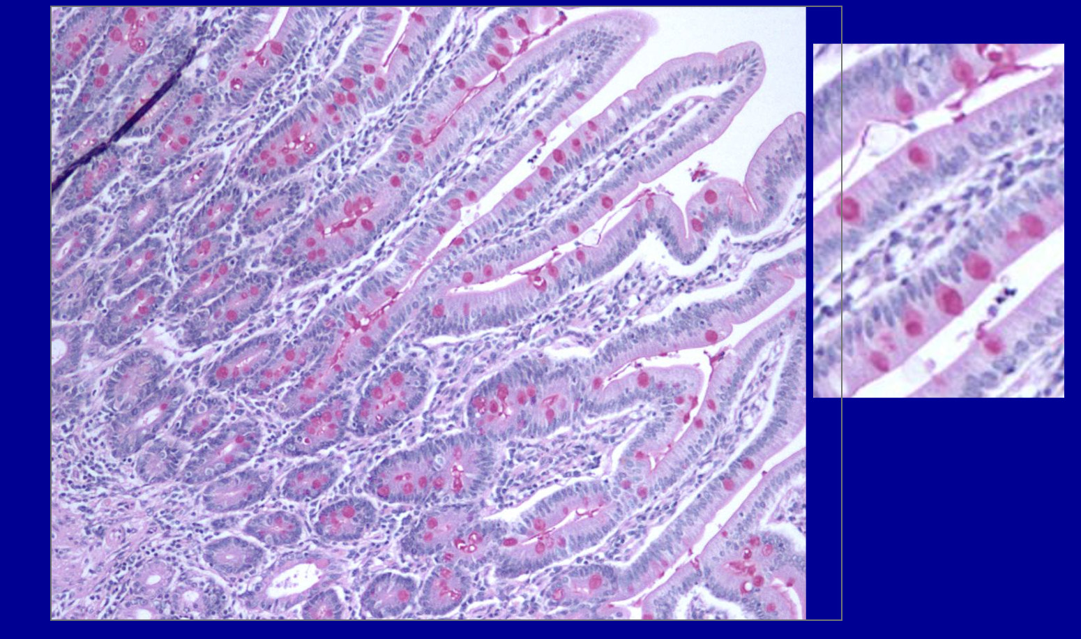 <p>ID the stain type </p>