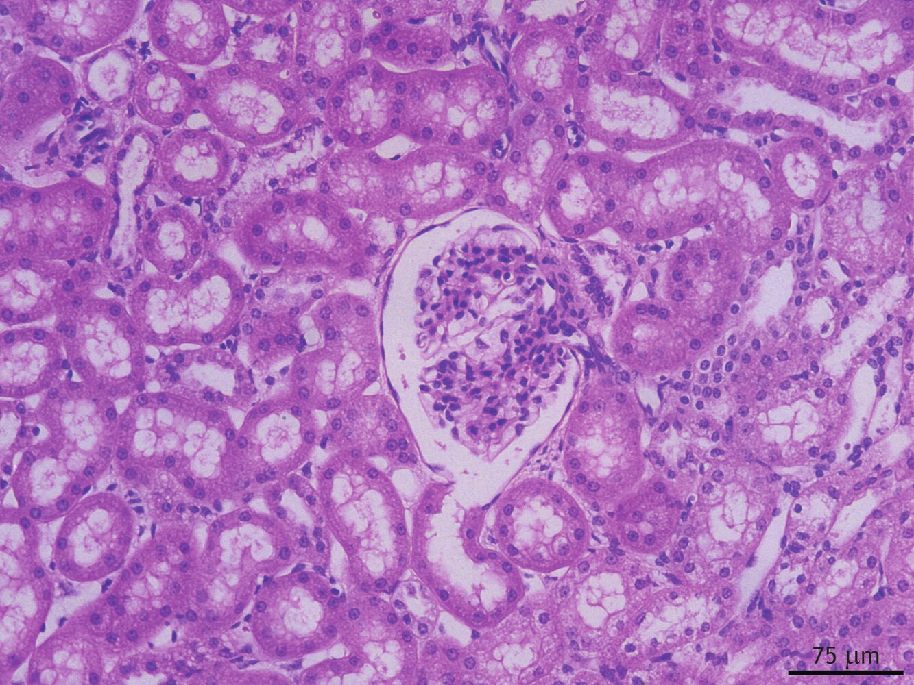 <p>47. This histological image shows a section of renal (kidney) tissue, stained with hematoxylin and eosin (H&amp;E). You can see several tubules and a glomerulus clearly.</p><p>Which of the following structures is not visible in this image?</p><p>A. Proximal tubule</p><p>B. Distal tubule</p><p>C. Bowman’s capsule</p><p>D. Macula densa</p><p>E. Collecting duct (Sammelrohr)</p>