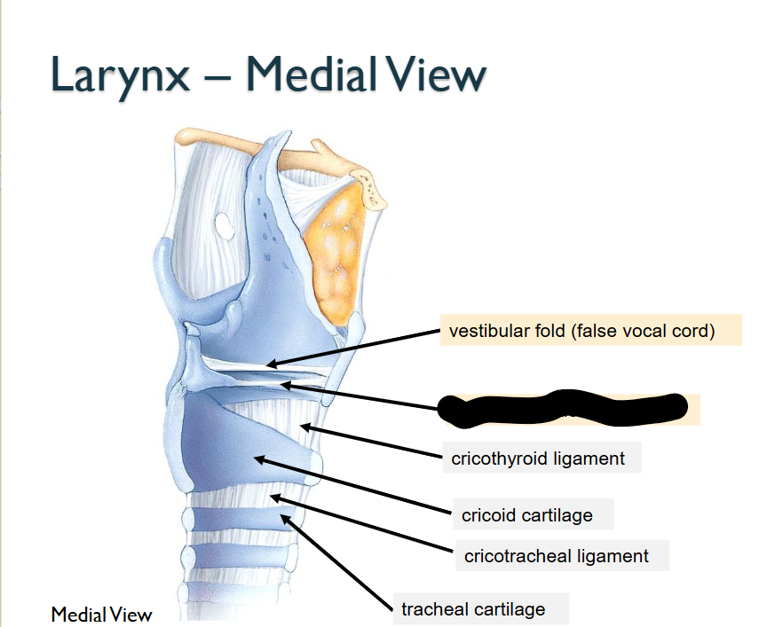 <p>What structure is this, within the<strong> Larynx - MEDIAL</strong></p>