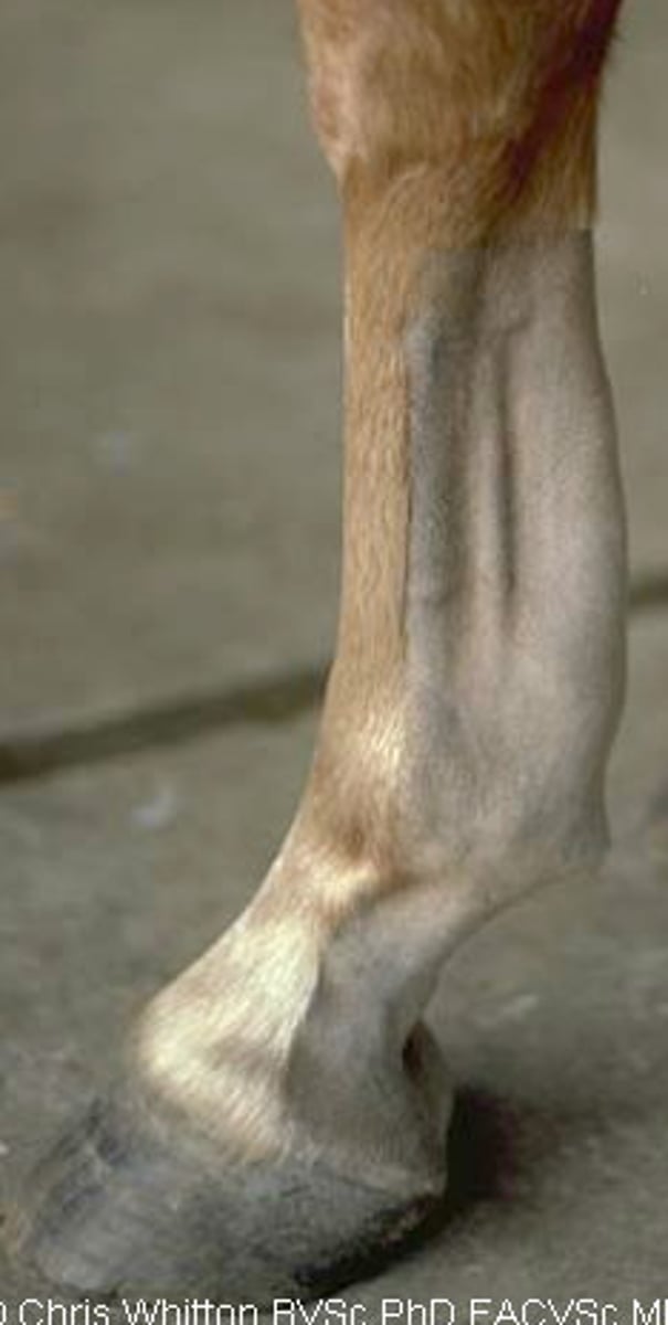 <p>Hemorrhage inside tendon sheath due to severe strain (superficial or deep flexor tendon)</p><p>Occurs in fatigued horses, usually on forelimbs</p><p>Thickened palmar surface of cannon</p>