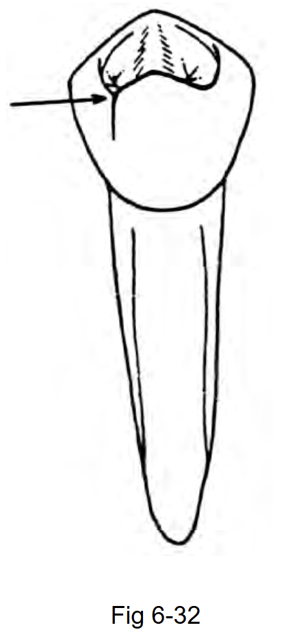 <p>On Fig 6-32, the arrow points to which landmark?</p>