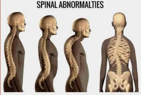 <p>what is the first spine</p>