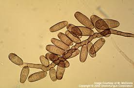 <p>Microscopy Conidia</p>