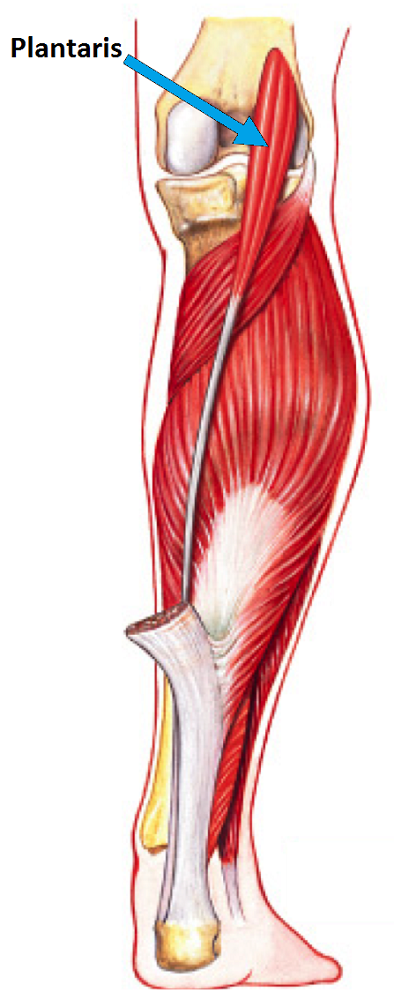<p>Small muscle with long thin tendon between gastroc & soleus weak plantar flexor. (N. tibialis). 🔎 Slender line running to Achilles tendon. 💡 "Plantaris = tiny helper."</p>