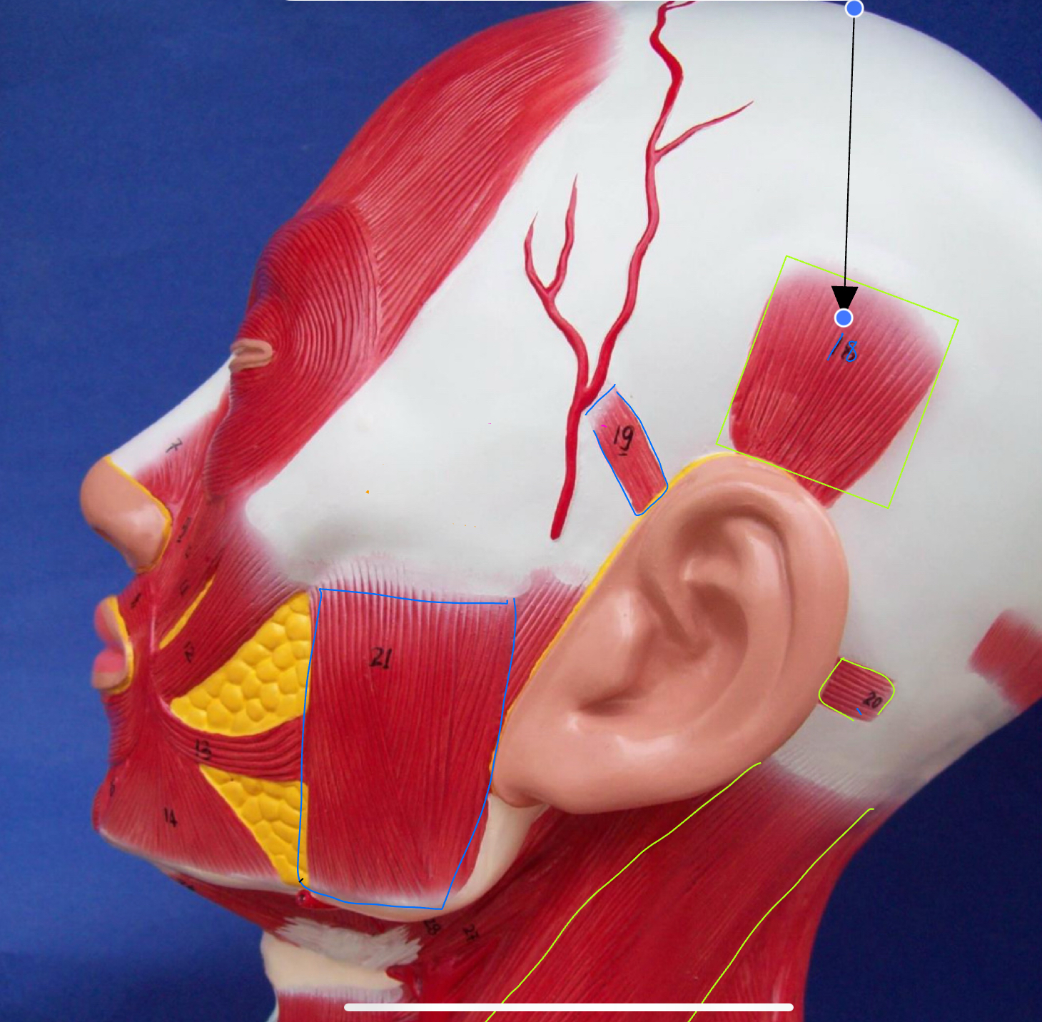 <p>What type of muscle is this ( altay model )</p>