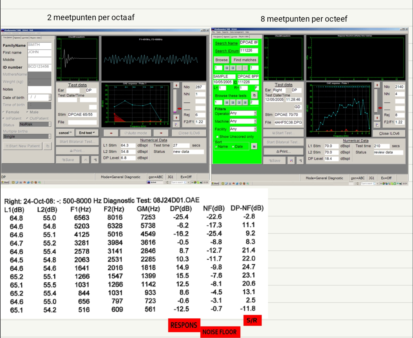 <p>•<strong>DPOAE RESPONS IS BEOORDEELD ALS AANWEZIG ALS DE S/R GROTER IS OF GELIJK AAN 6 dB (sommige onderzoekers verkiezen 12 dB)</strong></p><p><strong>DPOAE RESPONS AMPLITUDE MOET&nbsp; MINIMAAL -10 -10 dB SPL BEDRAGEN</strong></p><p><strong>(bij audiometrie ist maar 1 meetpunt per octaaf!)</strong></p><p><strong>bij voorbeeldje met cijfertjes → 3 meetpunten per octaaf (kan je zien door tussen de F te kijken → tussen 1000 en 2000 =3 meetpunten) </strong></p><p><strong>S/R moet groter zijn of gelijk aan 6!!</strong></p>