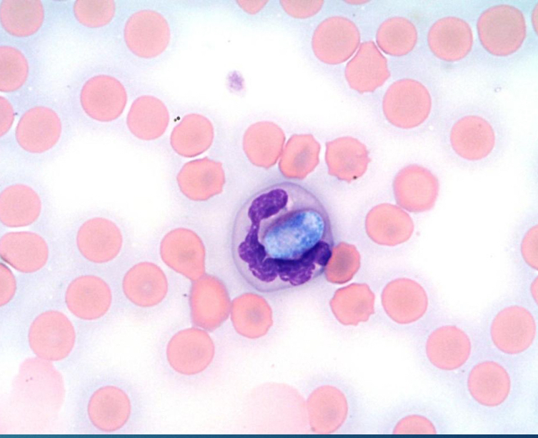 <p>Blood smear</p>