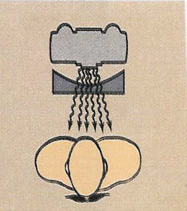 <p>what type of?</p>