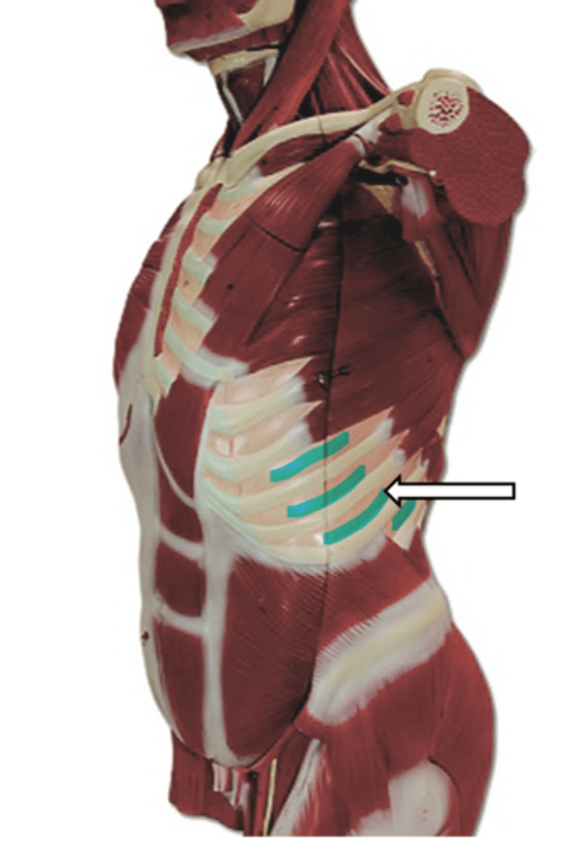 <p>name the muscle</p>