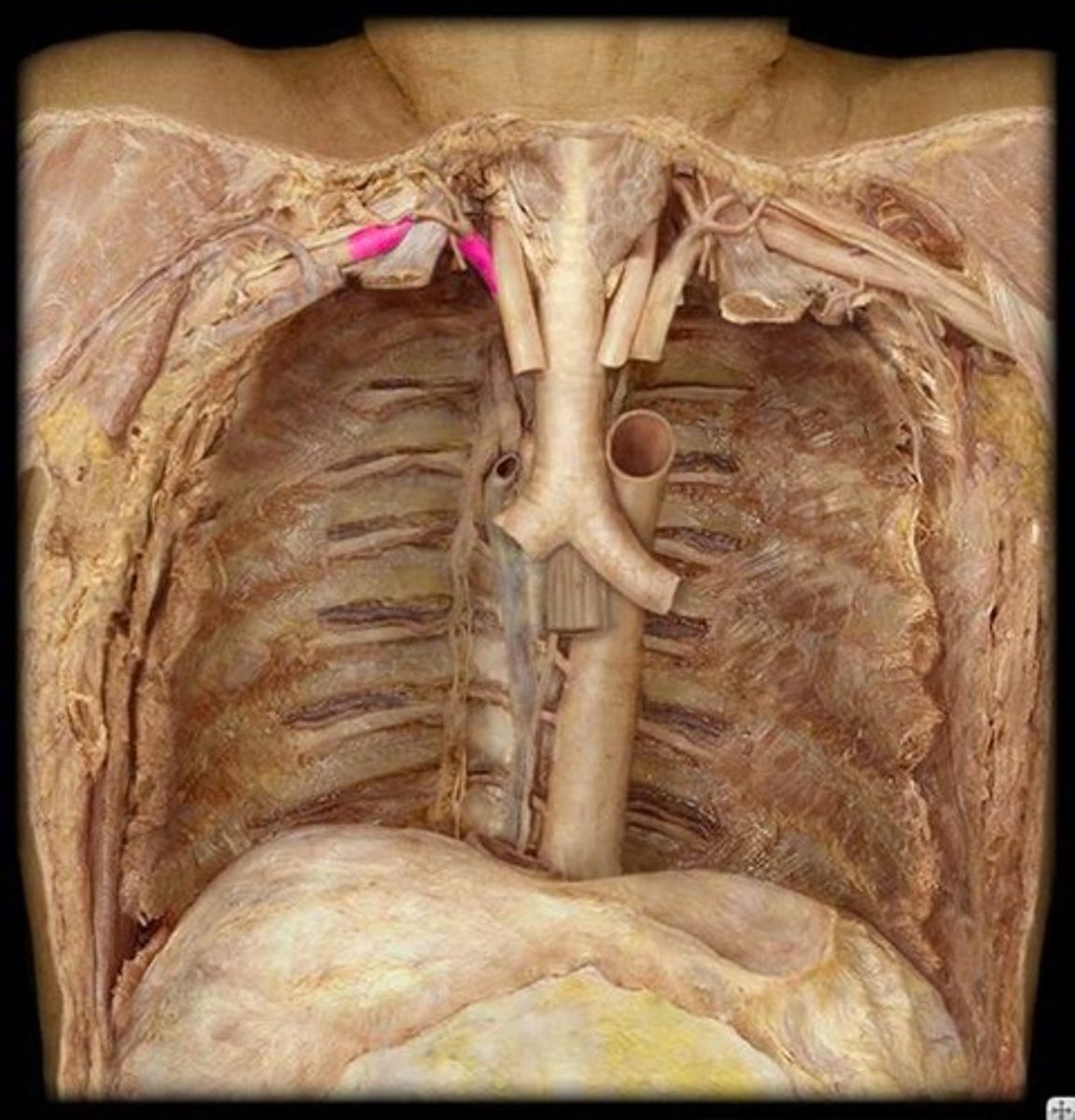 <p>Name this specific vessel (include the side).</p>