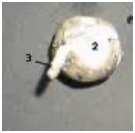 <p>What structure from the photo is labeled #3?</p><p></p><p>a. Sclera</p><p>b. Fovea centralis</p><p>C. Optic nerve</p><p>D. Optic tract</p>