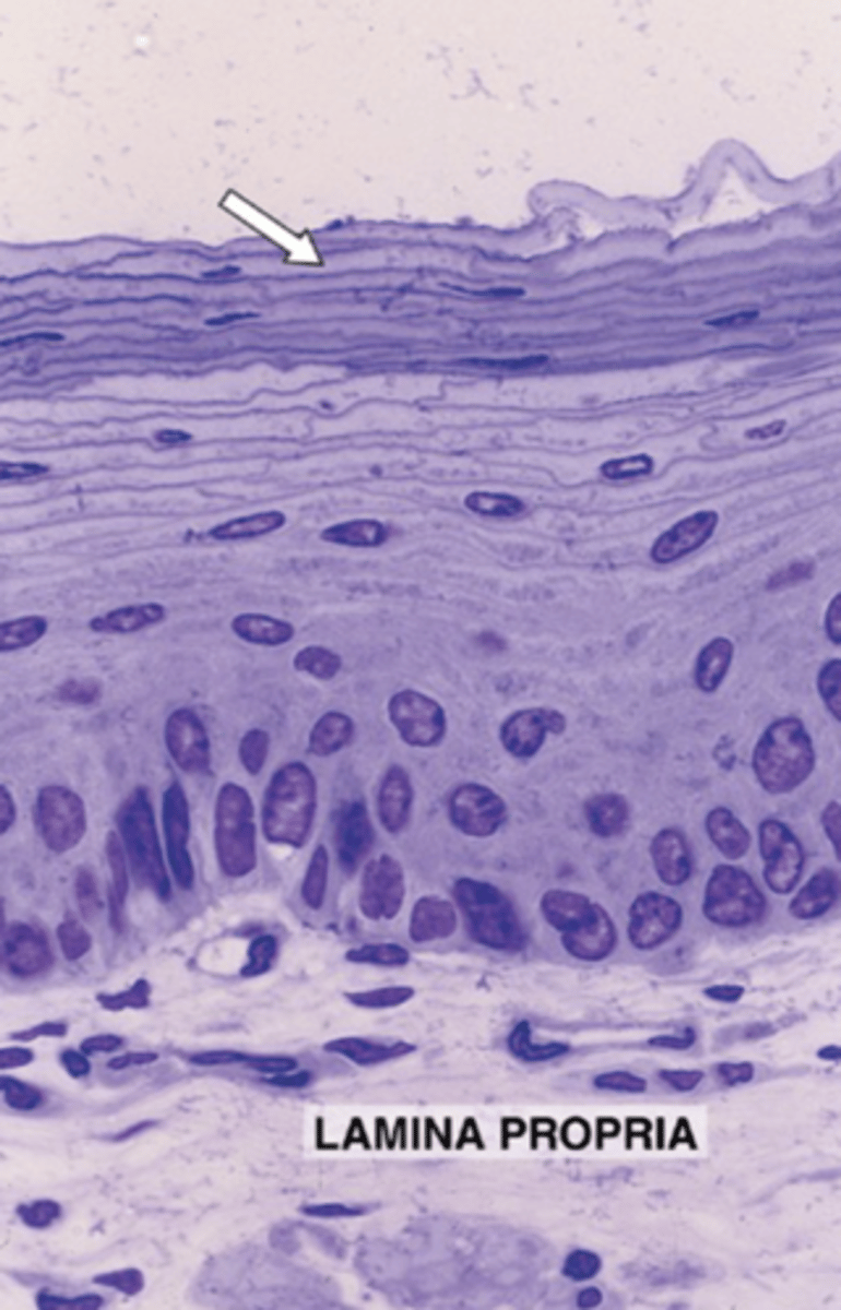 <p>Classify the epithelium indicated by the arrow.</p>