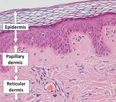 <p>middle layer of skin; contains blood and lymph vessels, nerves and other structures, such as hair follicles and sweat glands</p><ul><li><p>papillary layer (superficial)</p></li><li><p>reticular layer (deep)</p></li></ul><p></p>