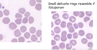 <p>What is the genus, species, and stage of this parasite?</p>