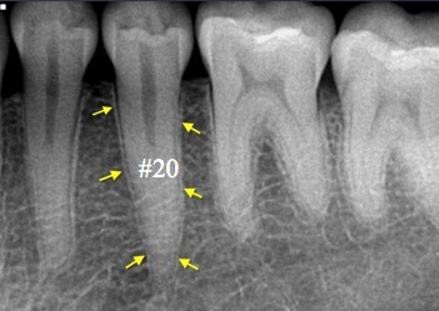 <p>Identify hard tissue</p>