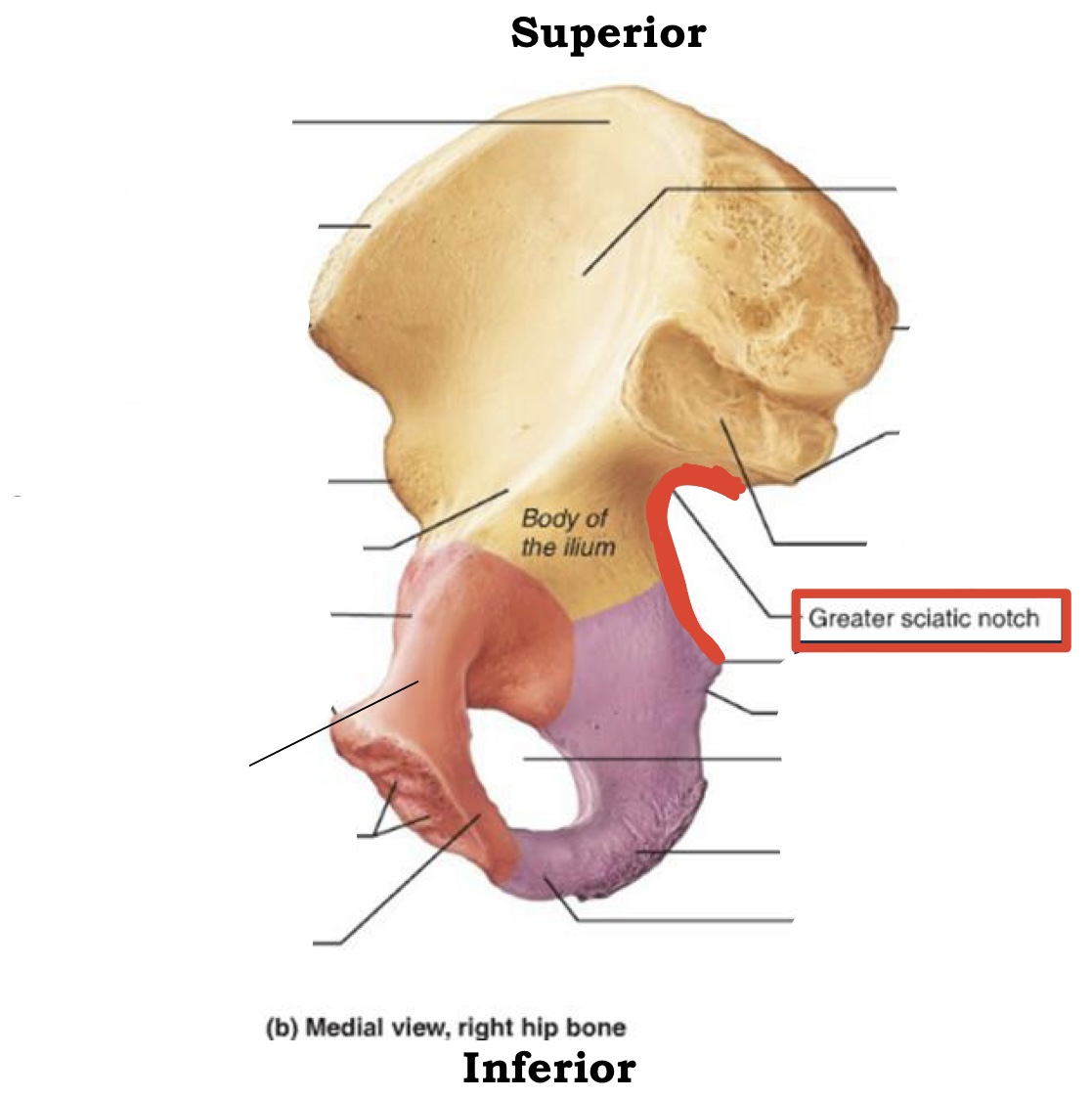 <p><span><span>Greater Sciatic notch</span></span></p>