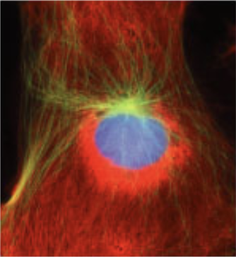 <p>what stage of mitosis?</p>
