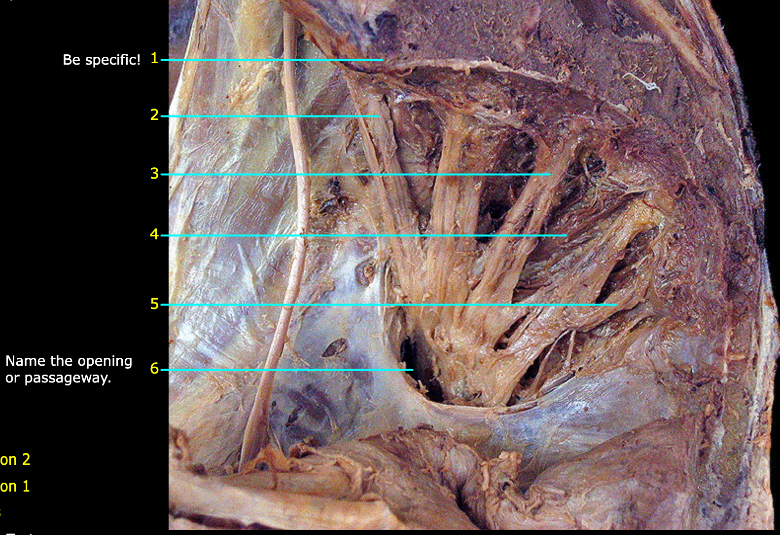 <p>What structure is labeled 4?</p>