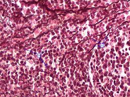 <p>Loose connective tissue with reticular fibers forming a stroma in lymphoid organs.</p>