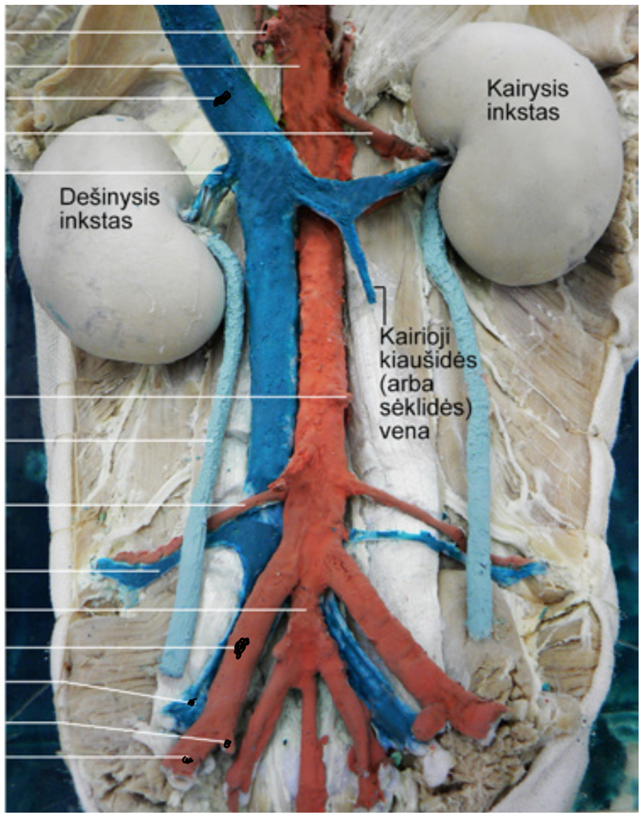 <p>Isvardink kraujagysles</p>
