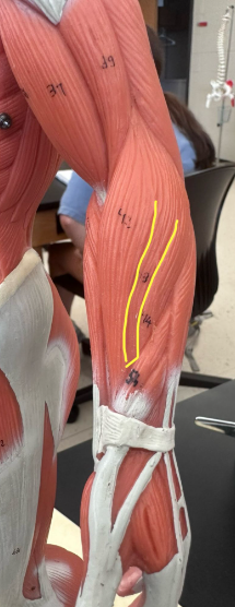 <p>What muscle is the yellow line indicating?</p>