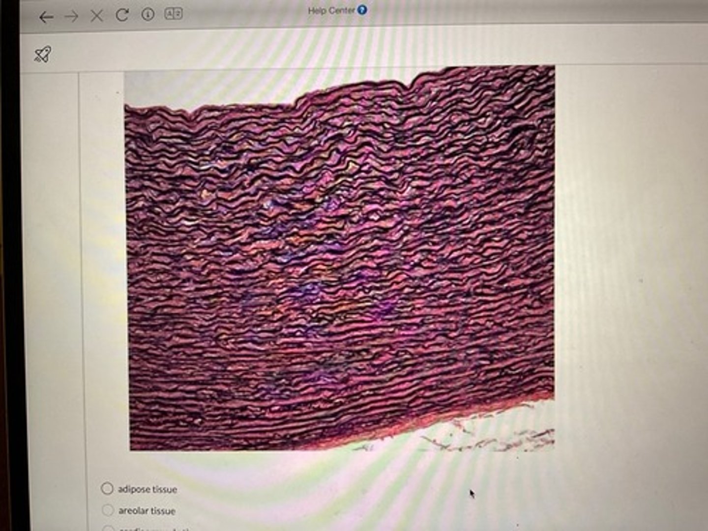 <p>Tissue that looks like bundles of dark, wavy elastic fibers packed closely together, giving it a stretchy, rubber band-like appearance that lets organs and ligaments expand and recoil.</p>