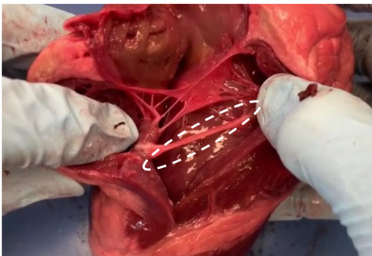 <p>found only on the right ventricle (you can find this only on the real heart model)</p>