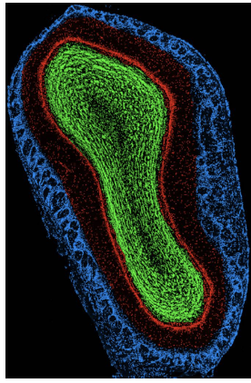 <ul><li><p>tubular</p></li><li><p>cells/neuropils arranged in concentric rings like onion layers</p></li></ul><p></p>