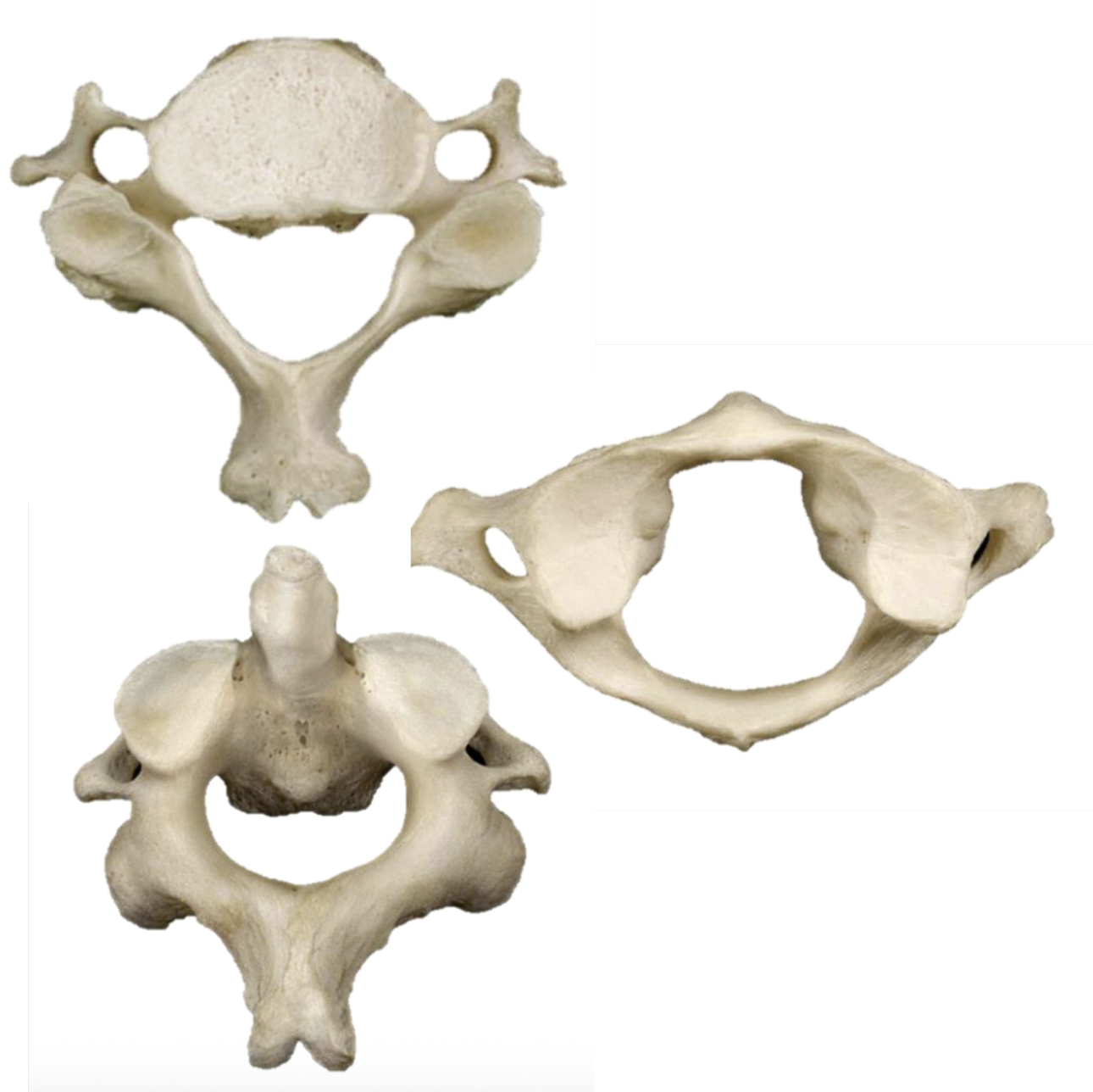 <p>What Type Of Bones Are These?</p>