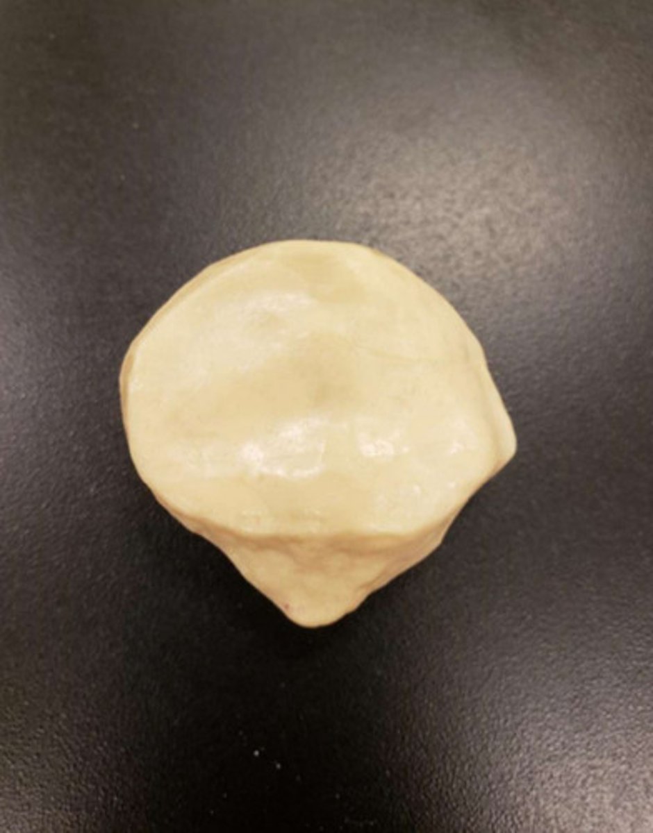 <p>anterior/posterior of patella</p>