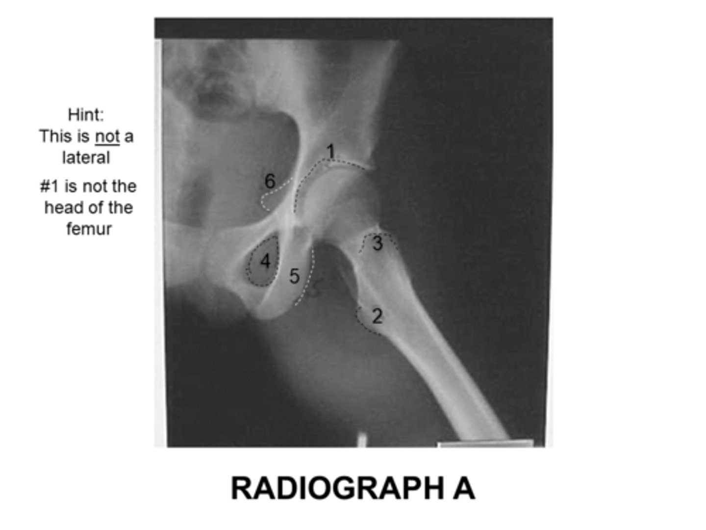 <p>The anatomy marked with #6 is the:</p><p>Acetabulum</p><p>Lesser trochanter</p><p>Obturator foramen</p><p>Greater trochanter</p><p>Ischial spine</p>