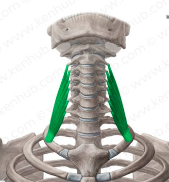 <p>Scalenus medius insertion</p>
