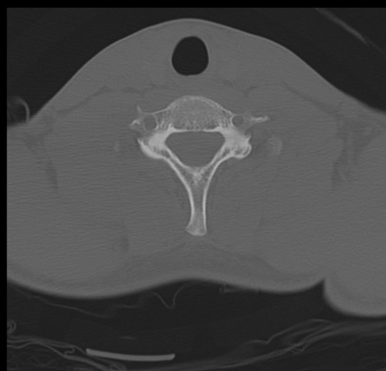 <p>What plane is this?</p>