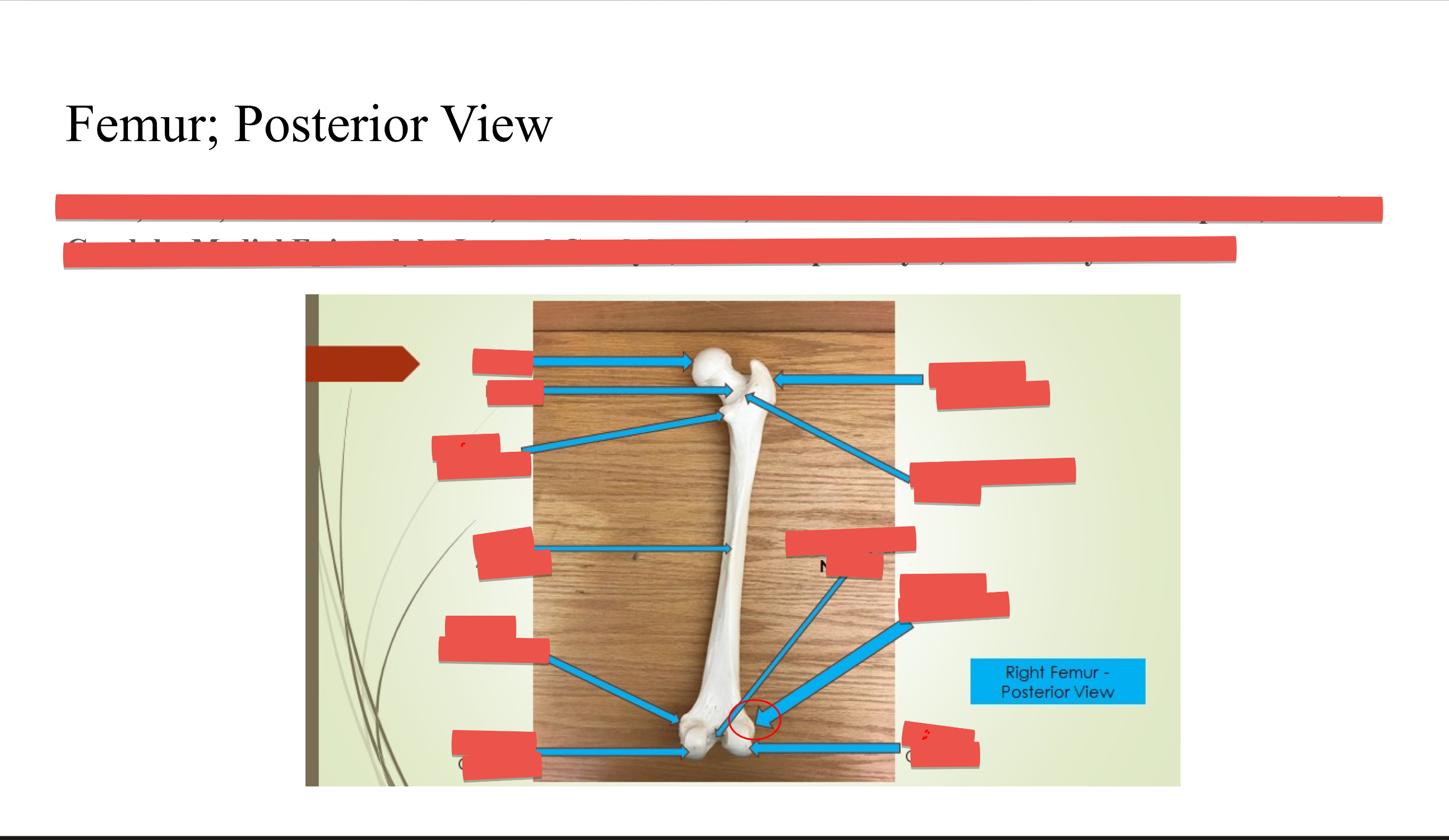 <p>Lateral Epicondyle </p>