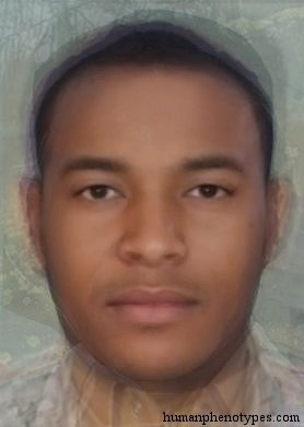 <p>Identify this Phenotype</p>