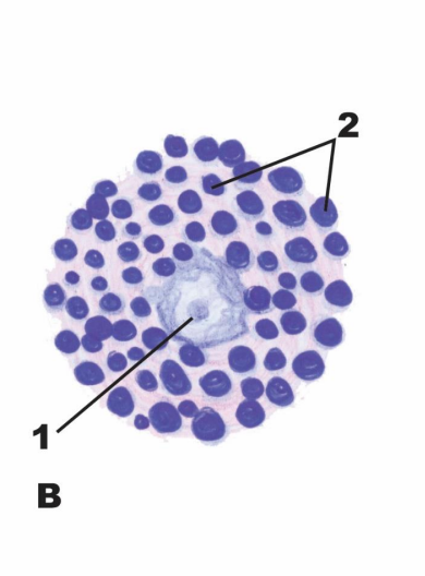 term image
