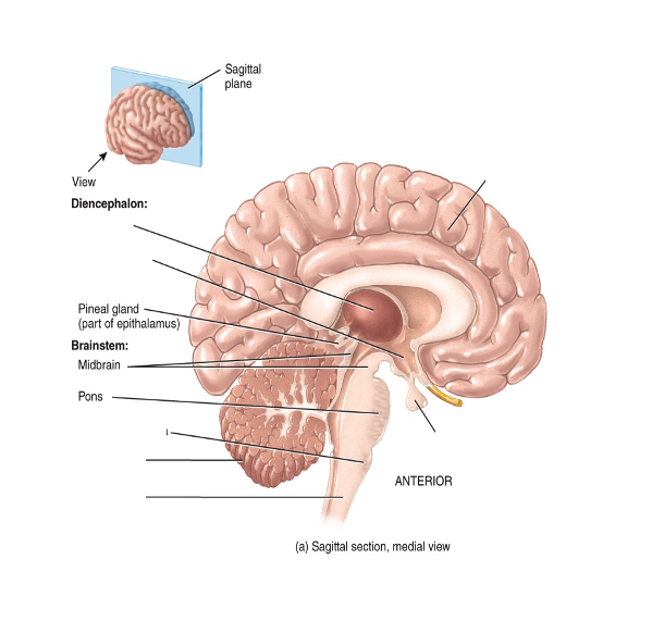 Label the diagram