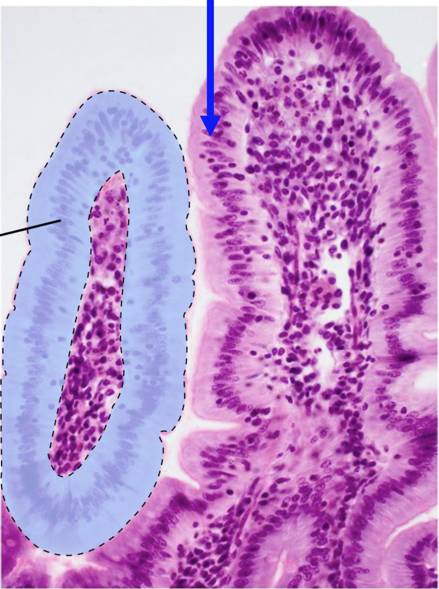 <p>What is the arrow point at?</p>
