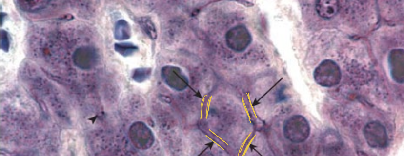 <p>what are the yellow lines indicating</p>