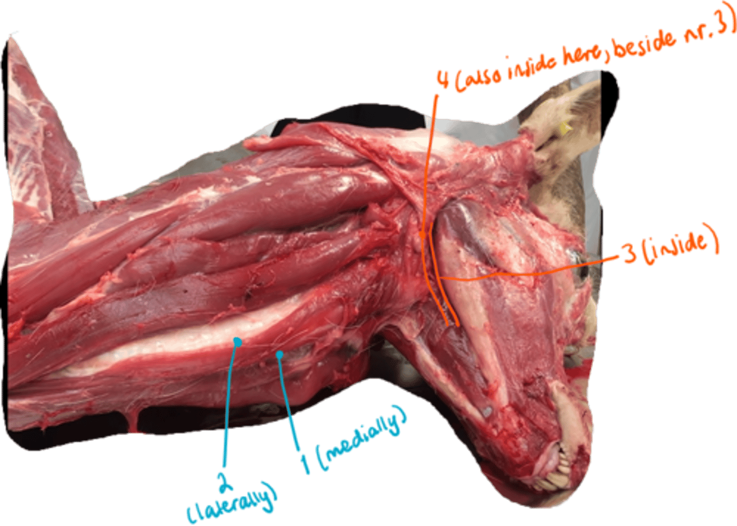 <p>identify the 2 types of muscles here.</p>