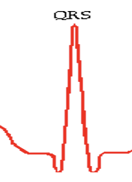 Represents ventricular depolarization and includes atrial repolarization, resulting from Purkinje fibers exciting the ventricular walls.