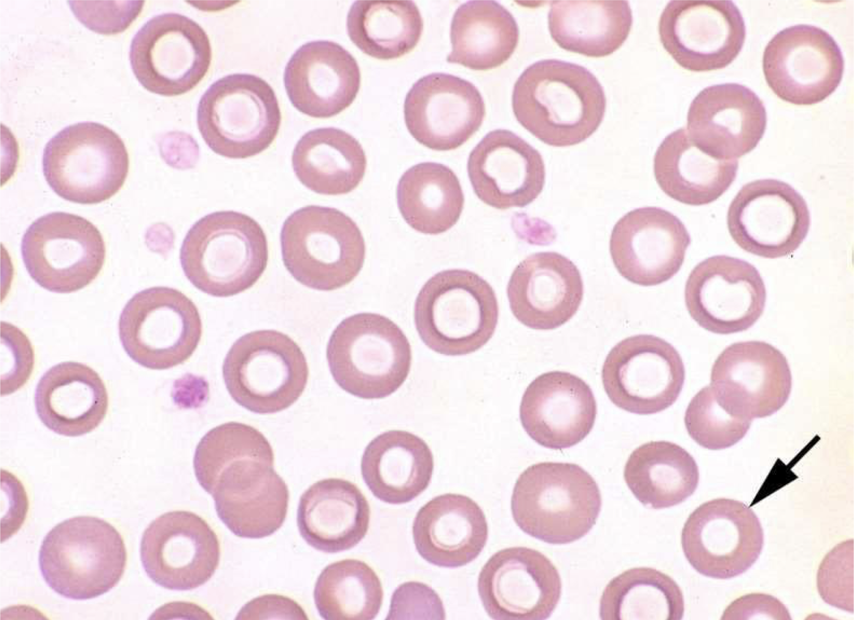 <p>what is the arrow pointing to in this image?</p>