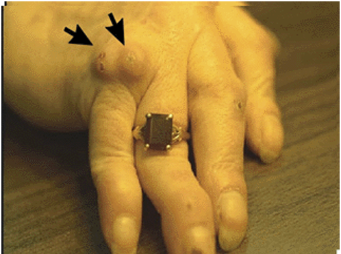 <p>What condition is this</p>