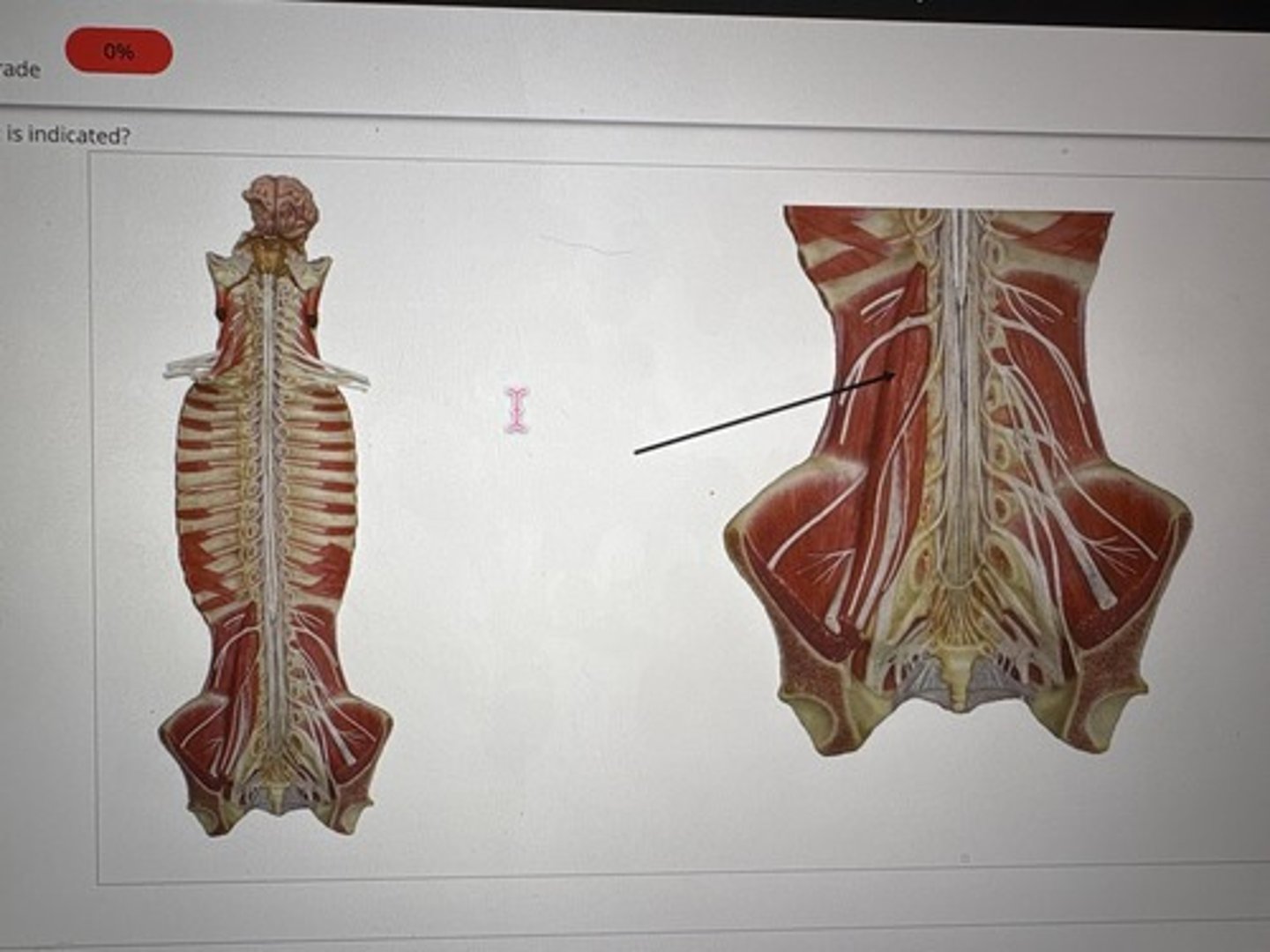<p>What is the muscle that is indicated</p>